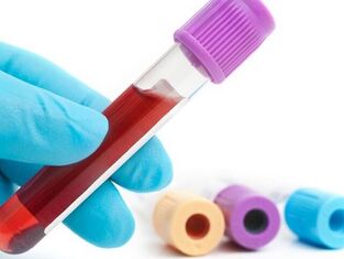 Métodos de laboratório