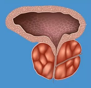 Características da prostatite