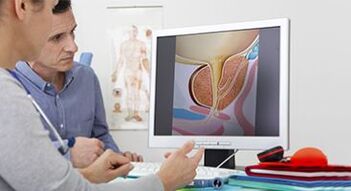 diagnosticar prostatite em um homem